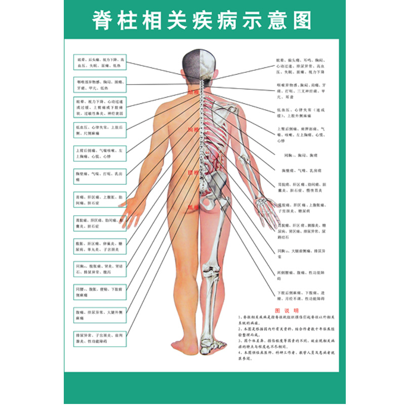 脊椎相关疾病示意图人体器官解剖图海报医院布置脊椎