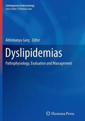 【预订】Dyslipidemias: Pathophysiology, Eval...