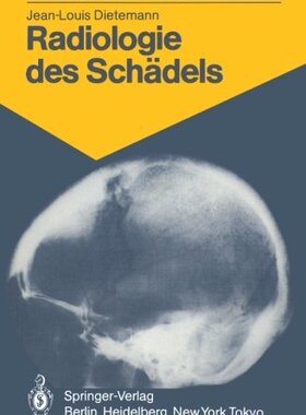 【预订】Radiologie Des Schadels: 103 Diagnos...
