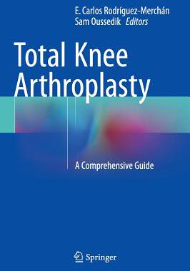 【预订】Total Knee Arthroplasty