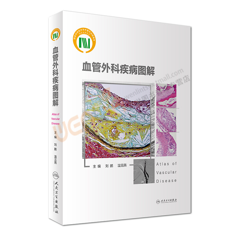 血管外科疾病图解 刘鹏 温见燕主编 人民卫生出版社9787117233255