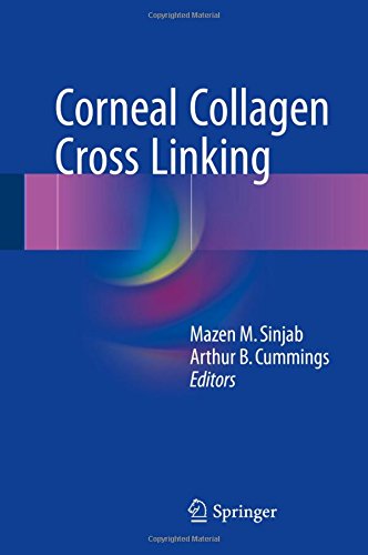 【预订】Corneal Collagen Cross Linking