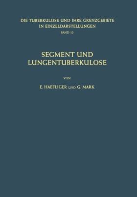 【预订】Segment Und Lungentuberkulose