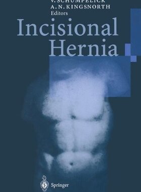 【预订】Incisional Hernia