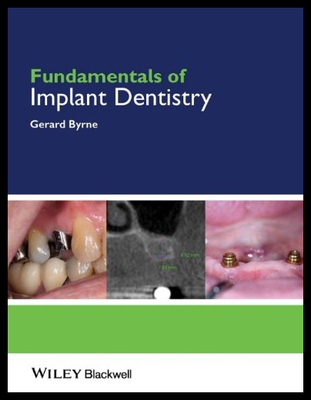 【预售】Fundamentals of Implant Dentistry