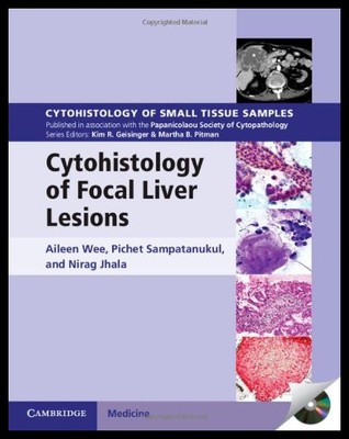 【预售】Cytohistology of Focal Liver Lesions