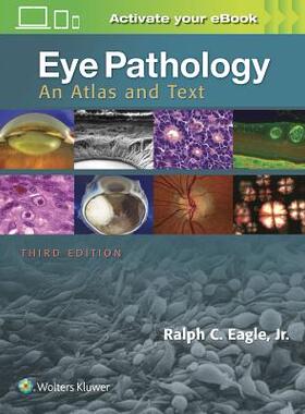 【预订】Eye Pathology