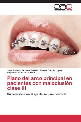 【预售】Plano del Arco Principal En Paciente...