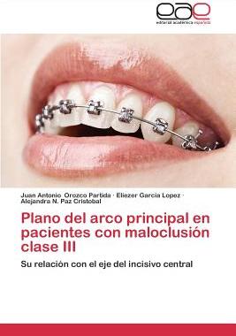 【预售】Plano del Arco Principal En Paciente...