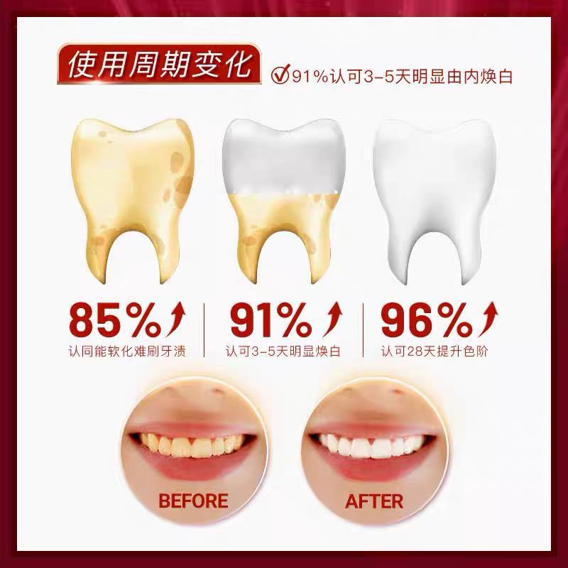 澳洲卡卡杜深导白牙膏 持久清z新口气 去渍去牙黄固齿抑菌牙膏