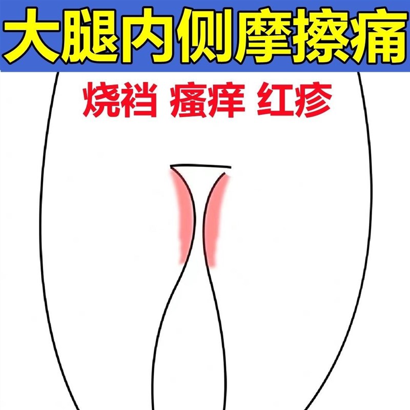 大腿内侧摩擦刺痛红肿起皮大腿根部淹红潮湿多汗走路疼磨伤烧裆