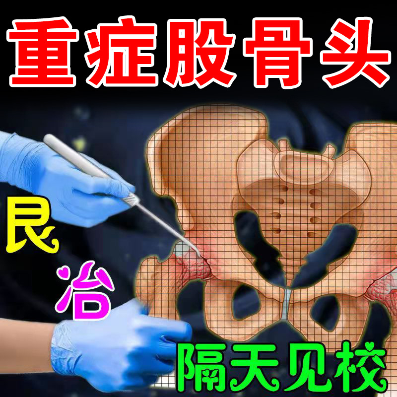 推荐【民间奇方】股骨头疼痛贴骶髂关...