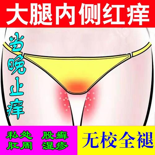 现货速发大腿摩擦红肿烧裆膏胖人走路磨大腿防摩擦膏腿根部瘙痒起