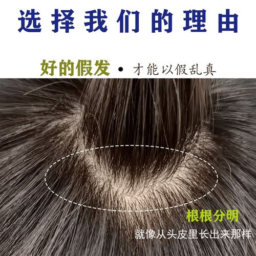 中老年女士头顶补发片全真发自然蓬松遮盖白发增发量短卷发补发块