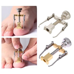 Nail-Recover-Tool Pedicure Ingrown Toenail Foot-Care Nail-Na