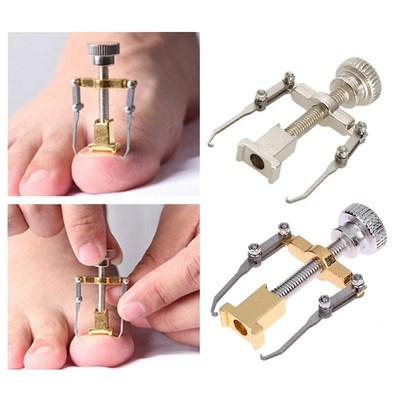 Nail-Recover-Tool Pedicure Ingrown Toenail Foot-Care Nail-Na