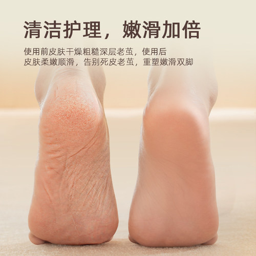 品尚电动磨脚皮自动磨脚去角皮死皮老茧刀修足机修脚器打磨护理