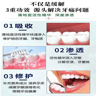 好后不再痛 速发 牙疼上火止疼杀死牙神经牙龈肿蛀牙护龈草本牙