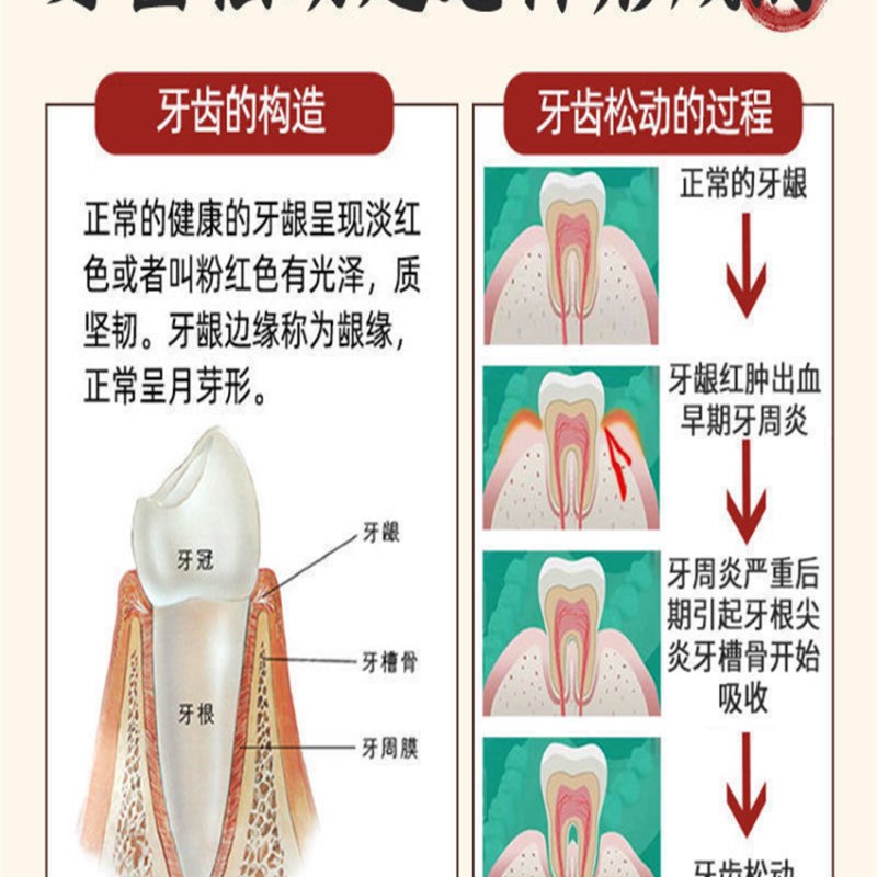 【牙松动不用拔】牙龈肿痛萎缩牙痛牙晃动固齿牙生修复再疼牙根TY