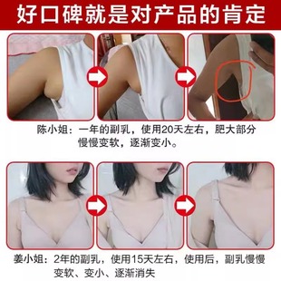 极速【最快7天收副乳】副乳消除贴云南腋下淋巴结节解散膏去副乳