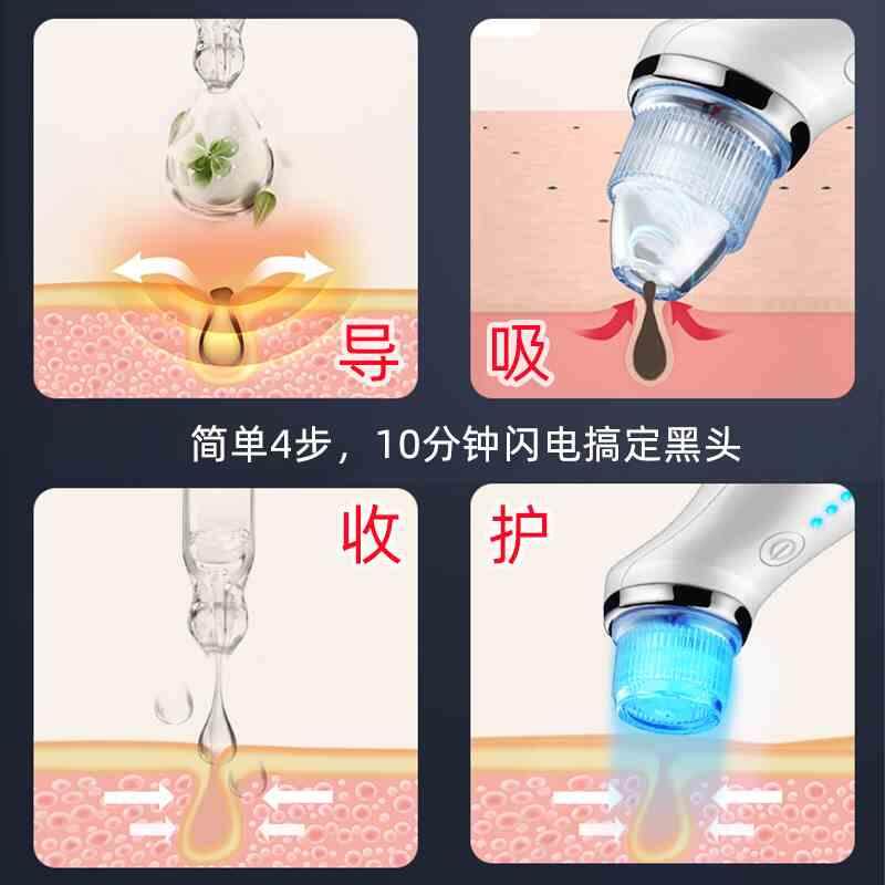 GOODSKY吸黑头神器小气泡美容仪器脸部去黑头毛孔家用.清洁吸出器
