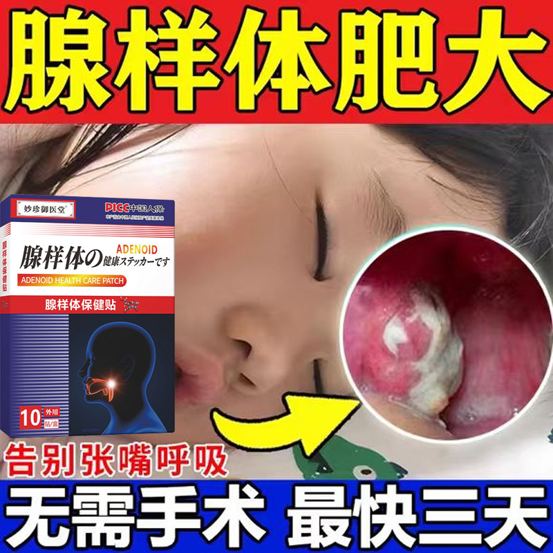 热销腺样体肥大中药贴面容矫正器调理儿童鼻塞不通气睡觉张嘴呼吸