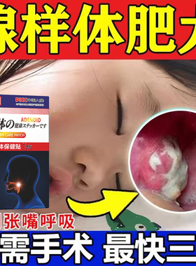 热销腺样体肥大中药贴面容矫正器调理儿童鼻塞不通气睡觉张嘴呼吸
