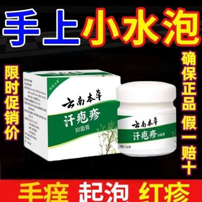 汗泡疱疹疱手痒脱皮汗孢疹汗状孢疹专用软膏手上起小水泡干裂药膏