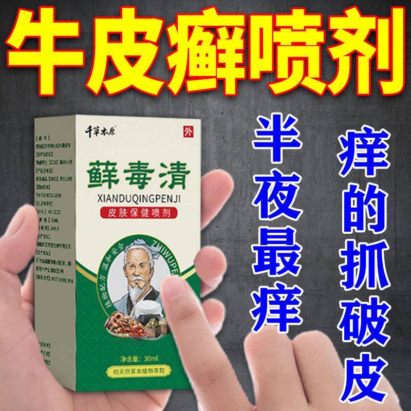 厂家牛皮癣喷剂银屑病皮焱湿疹皮肤瘙痒手足癣全身通w用藓毒清止