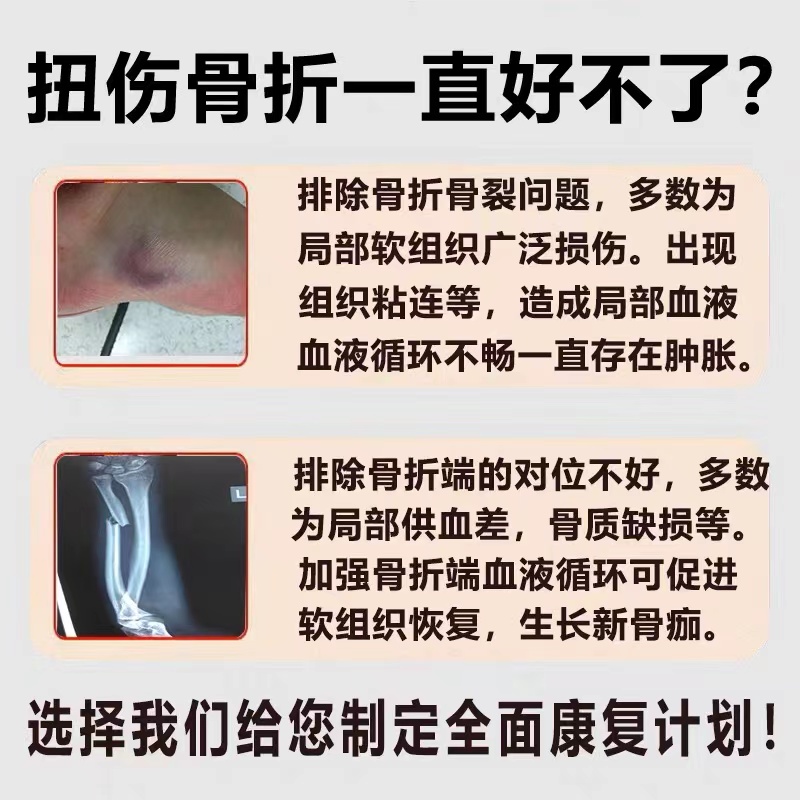 极速接骨续筋骨折骨裂恢复药膏韧带拉伤跌打损伤专用手腕脚踝扭伤