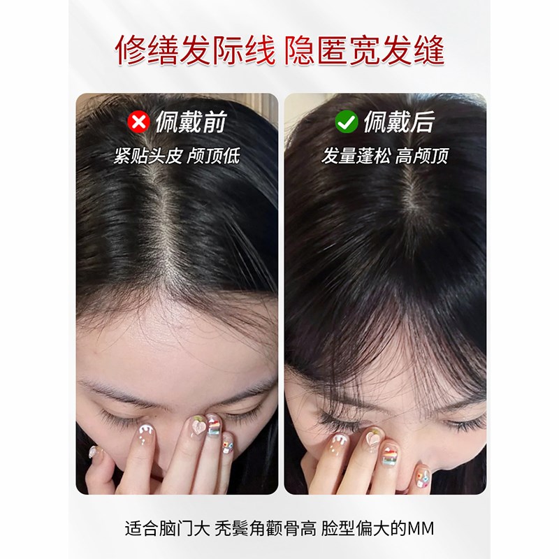 递针假发女片头顶补发蓬松全真发增发量遮白发自然无痕刘海假发片