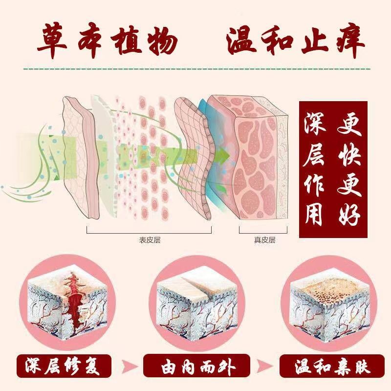 推荐苗锐苗方百毒膏草本乳膏牛皮癣膏湿疹膏皮炎过敏膏荨麻疹一抹