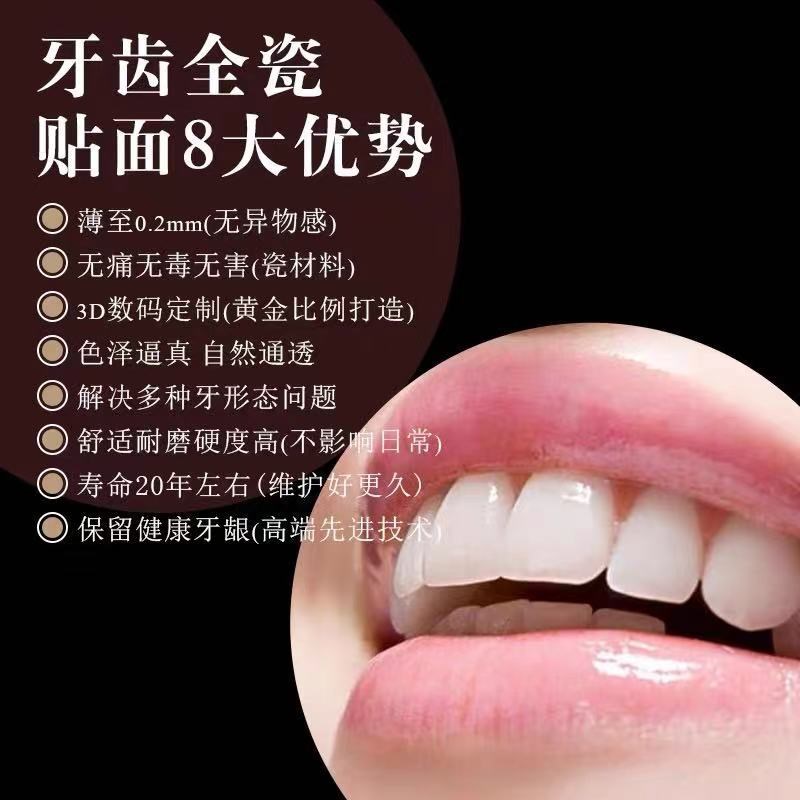 义获嘉全瓷贴面超薄牙贴进口贴片私人订制琥珀瓷贴面冰瓷陶瓷