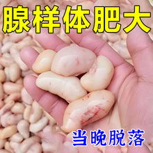 腺样体贴儿童鼻塞睡觉打呼噜张嘴呼吸G不通气腺样体肥大面容矫正Z