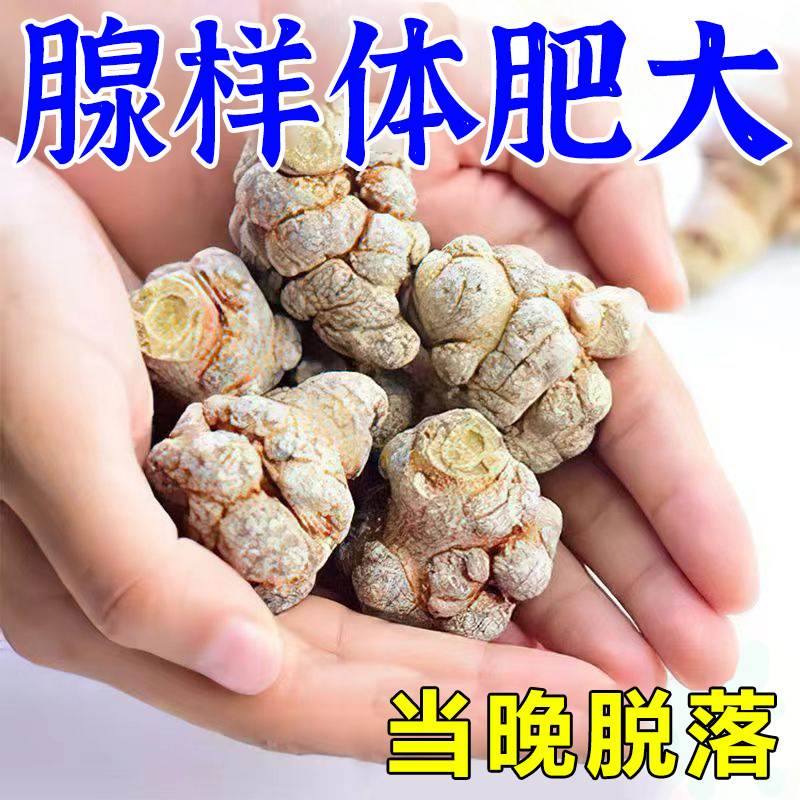 热销腺样体肥大面容中药贴儿童宝宝睡觉张嘴呼吸流涕鼻塞打鼾专用