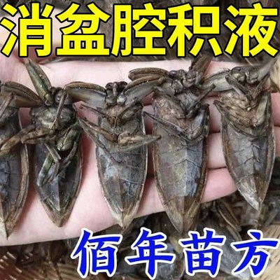 推荐盆腔积液中药贴治疗输卵- 管堵塞疏通宫腔粘连小腹痛膏药热敷