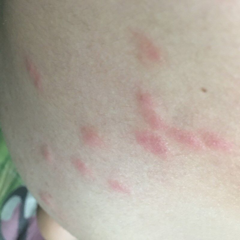 脚心痒牛癣皮1约快乐宝贝皮肤外用止痒药膏软膏  康支包邮