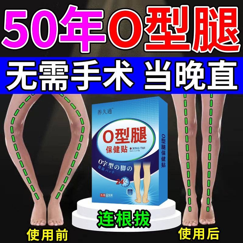 工厂销O型腿矫正神器纠正小腿外翻罗旋腿内外八字X/UO型腿大小腿