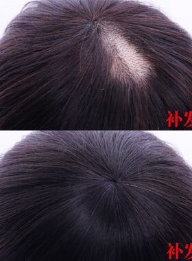 遮盖头顶头发稀少神器庶白发假发夹子固定女短发自然少女生补发