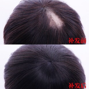 遮盖头顶头发稀少神器庶白发假发夹子固定女短发自然少女生补发