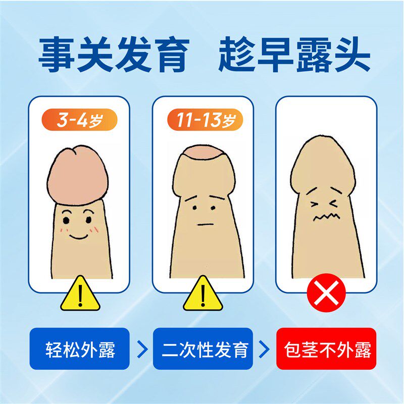 速发瑞宝宝儿童包茎扩张器包皮口撑开无痛免手术男孩家用矫正快速