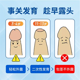 速发瑞宝宝儿童包茎扩张器包皮口撑开无痛免手术男孩家用矫正快速