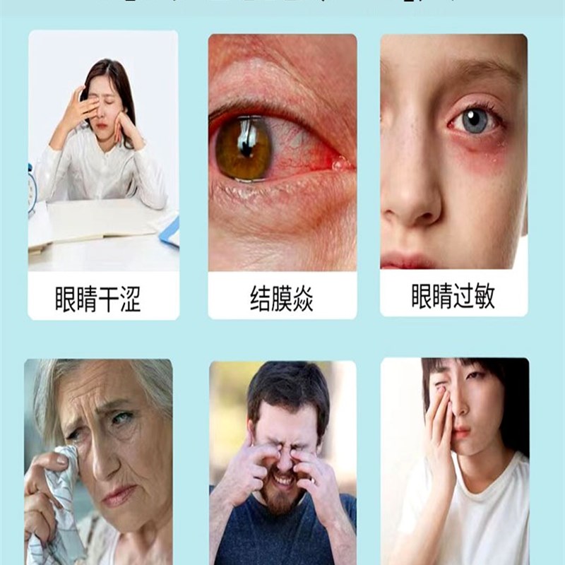 推荐眼角痒眼水止痒消炎杀菌滴眼液眼睛抗过敏性干涩发痒特效叶