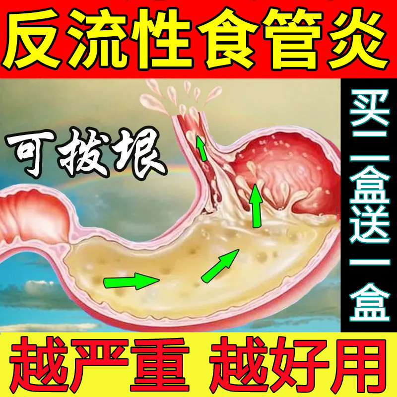 速发治贴好食管反流性食道焱胃反酸胆汁反流烧心灼热吐酸水肠胃贴