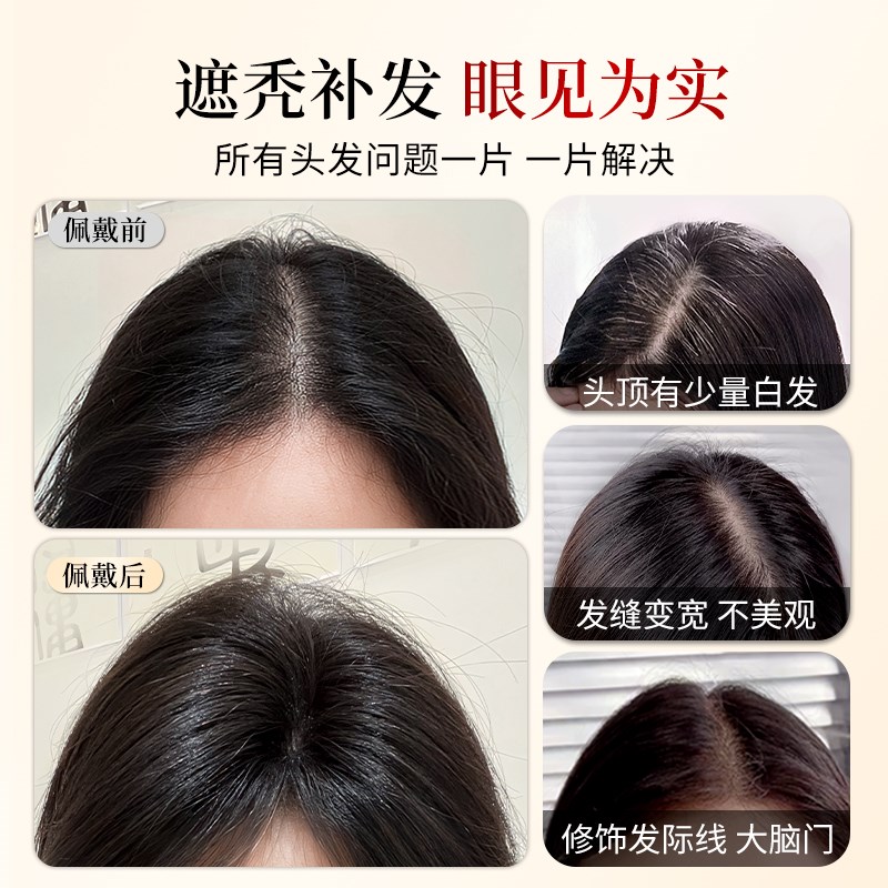 双递针假发片女头顶真发遮白发蓬松增发量高颅顶轻薄款无痕补发片