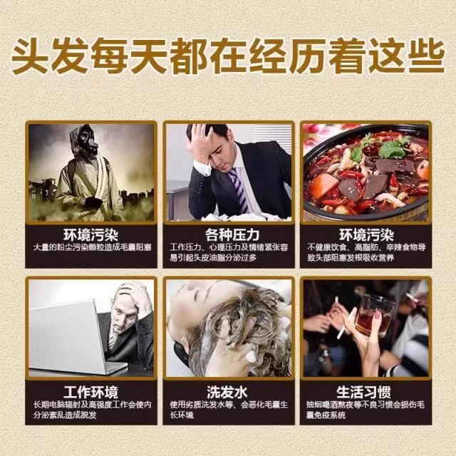 推荐斑秃治疗药鬼剃发生髪液增发男女脱发严重儿童防脱发掉发喷雾