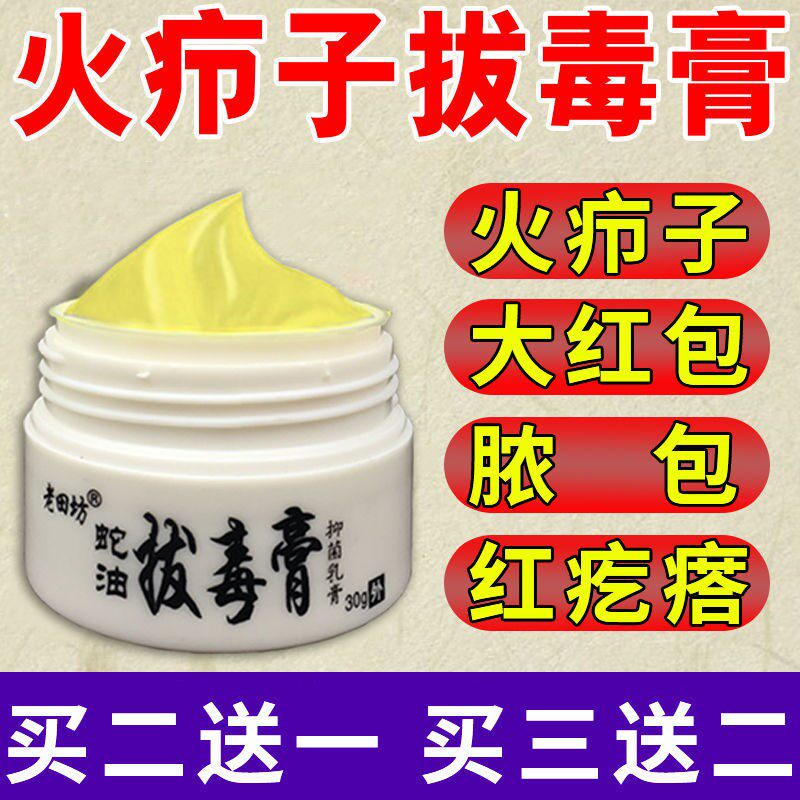 现货速发火疖子拔毒膏药拔吸脓头粉瘤皮脂腺囊肿膏脓包型皮下结节