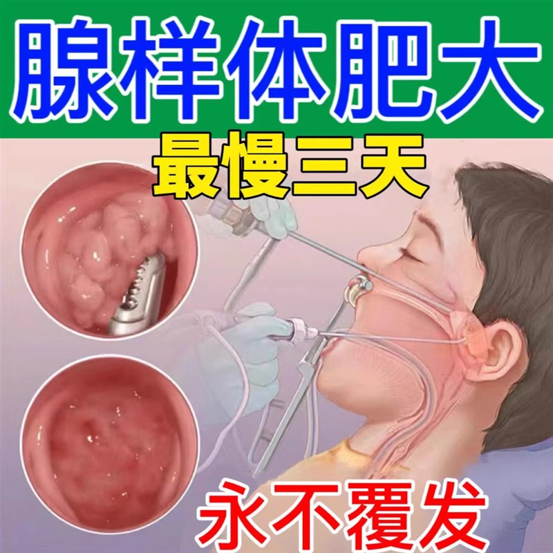 热销【专冶】腺样体肥大面容矫正器儿童调理总张嘴呼吸打呼鼻塞中