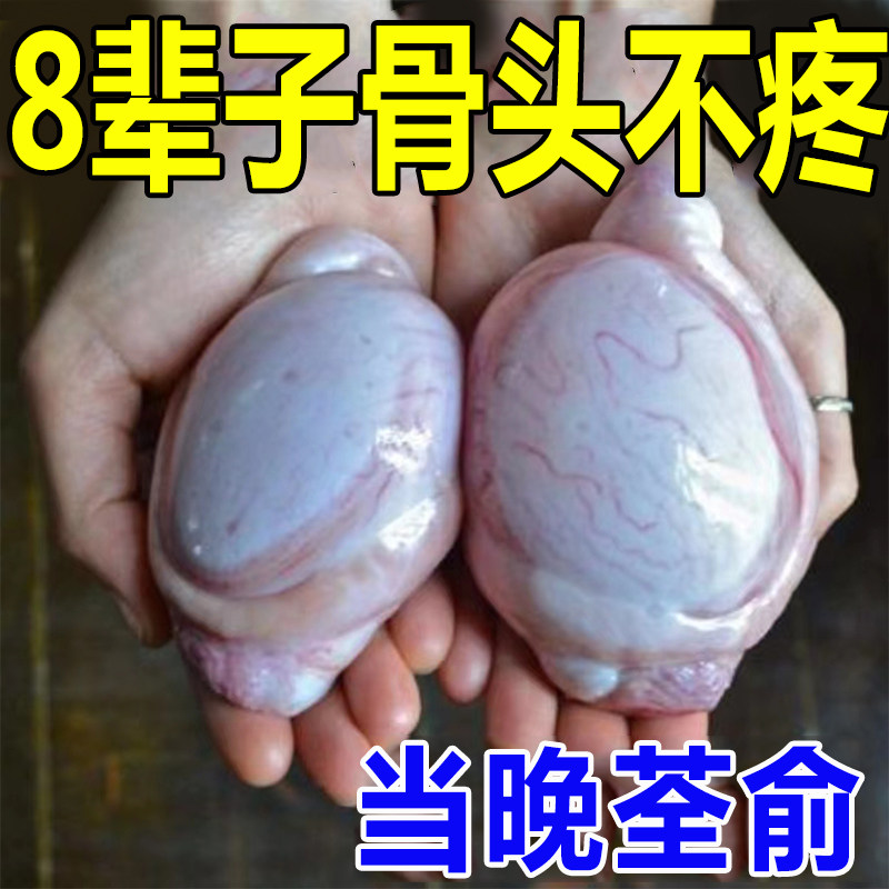 热销【100%彻底冶愈】股骨头髋关节疼痛缺血坏死肿胀股骨头坏死专