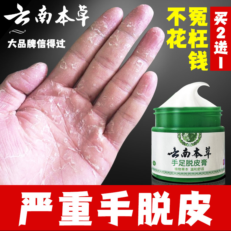 手脱皮手指上起皮干燥粗糙专儿童脚手掌蜕皮手v心掉皮退皮药膏